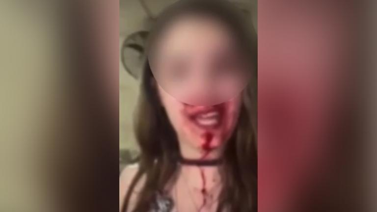 Άμφισσα: 23χρονη γυναίκα καταγγέλλει άγριο ξυλοδαρμό από τον σύζυγό της
